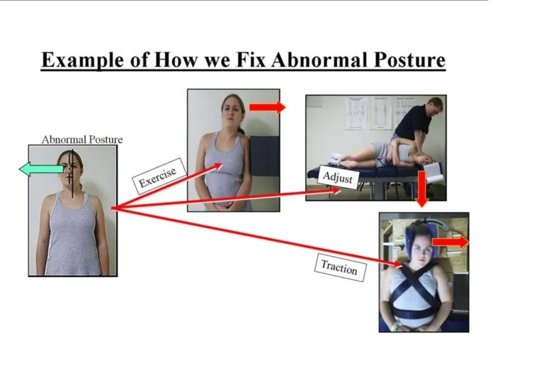 Corrective Chiropractor Bee Cave, TX - treatment